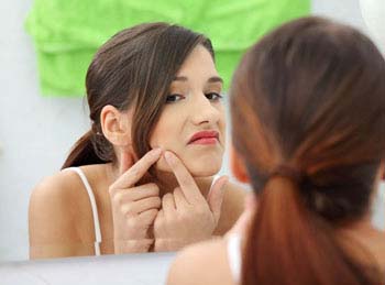 Summary of Acne Vulgaris