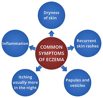 Symptoms of Eczema 2