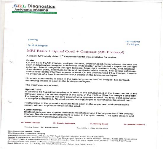 Before Treatment of Multiple Sclerosis